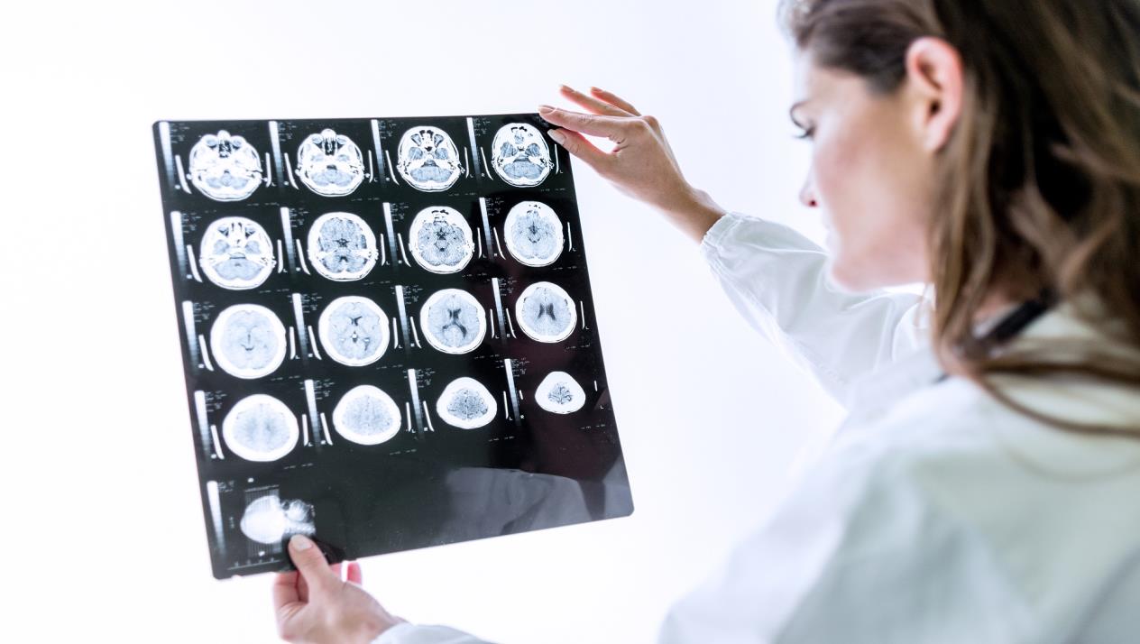 سرطان نقائل الدماغ| ما هو وكيف يحدث؟