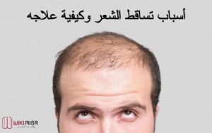 أسباب تساقط الشعر وطرق علاجه