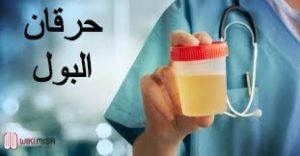 أسباب حرقان البول وأعراضه وطرق العلاج