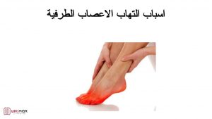 اسباب التهاب الاعصاب الطرفية