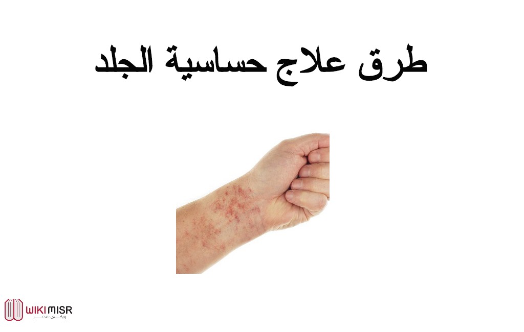 طريقة علاج حساسية الجلد 