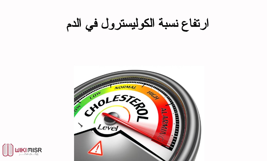 ارتفاع نسبة الكوليسترول في الدم وكيفية علاجه بطرق طبيعية