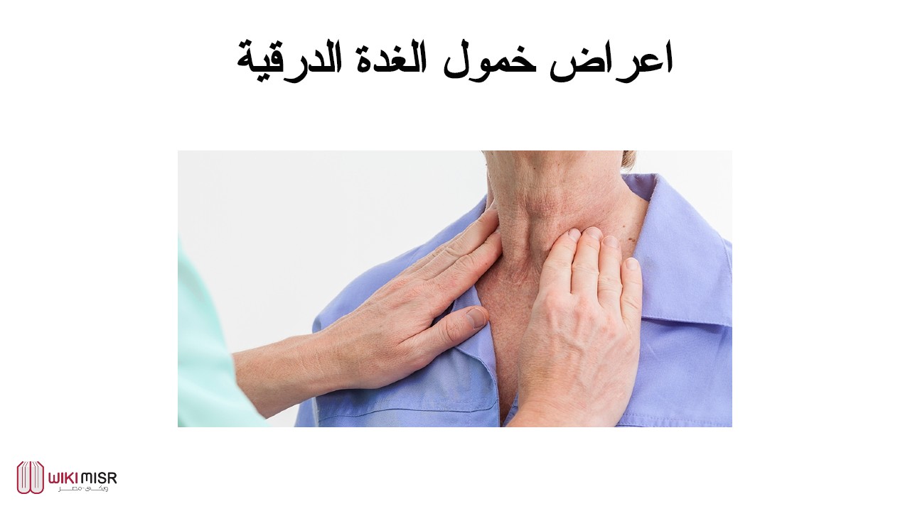 أعراض خمول الغدة الدرقية وأهم أسباب الإصابة ويكي مصر Wikimisr