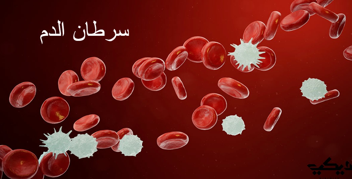 أعراض سرطان الدم وأهم أنواعه