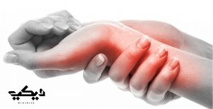 أسباب التهاب الأعصاب أعراضها وطرق علاجها