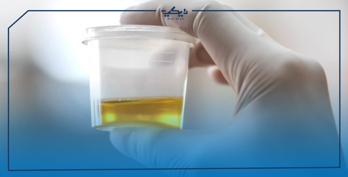 علاج الاملاح في البول اعرف الأعراض ويكي مصر