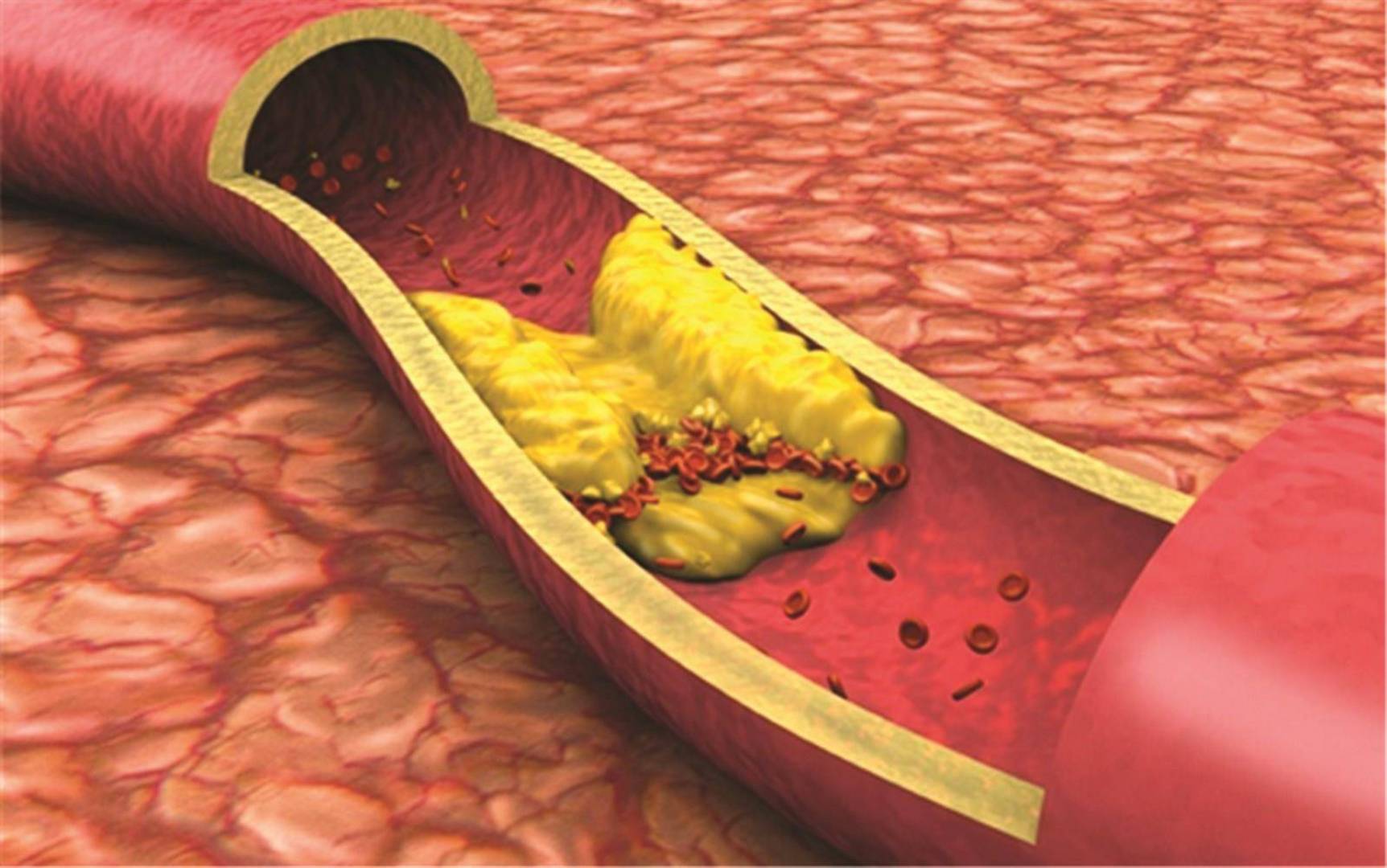 cholerose 10 موانع استعمال الآثار الجانبية تحذيرات عند استخدام
