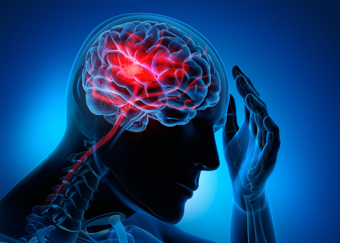ما هي جلطة المخ .. أعراض الجلطة الدماغية قبل حدوثها