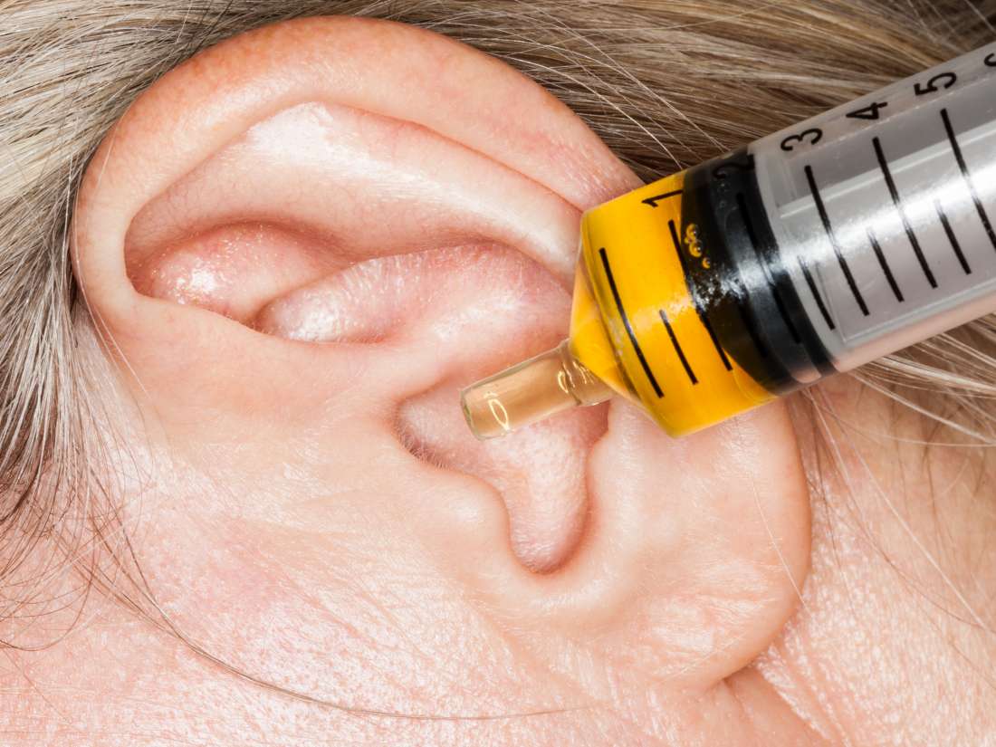 علاج التهاب الأذن