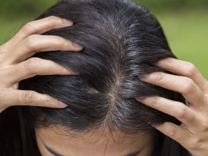 ﻿biotin forte للشعر