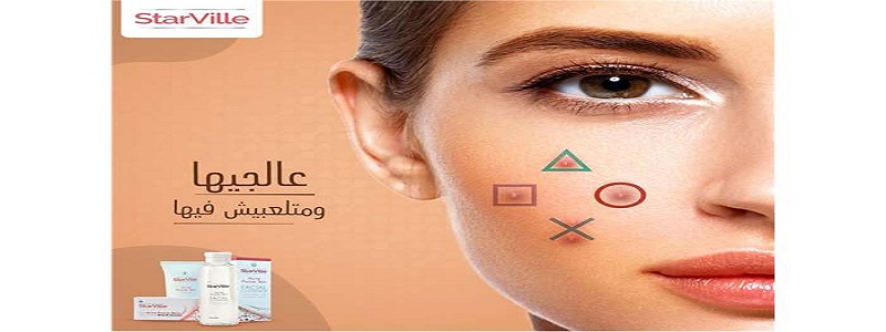 Starville acne cream لعلاج حب الشباب