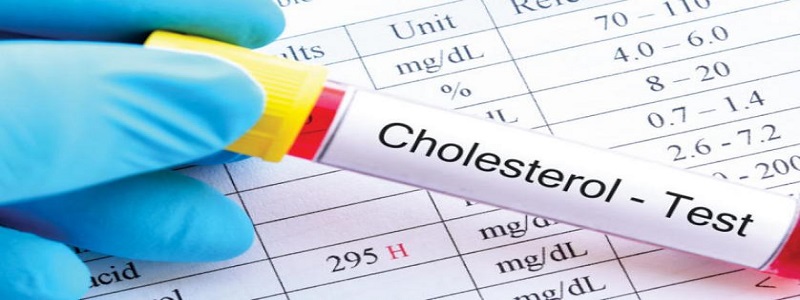 علاج الكوليسترول | أضرار ارتفاع الكوليسترول في الدم