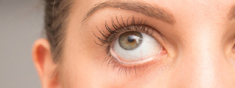 علاج جفاف العين أدوية علاج جفاف العيون