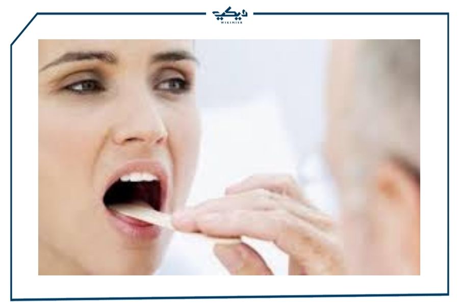 أدوية علاج التهاب الحلق في الصيدليات المصرية ويكي مصر