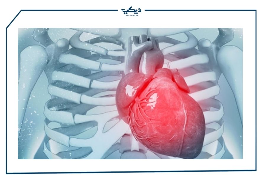 طرق علاج ضعف عضلة القلب ويكي مصر