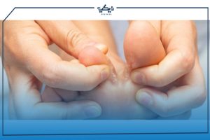 ادوية علاج فطريات القدم