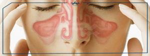اسرع علاج للجيوب الانفية