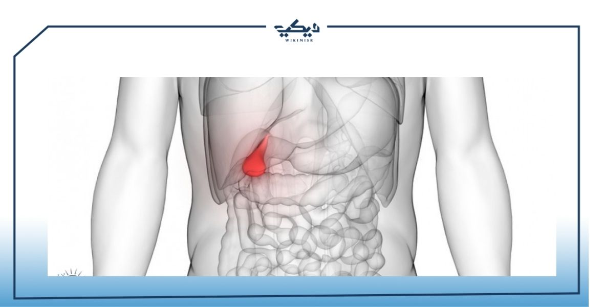 ما هي اعراض المرارة الملتهبة ويكي مصر
