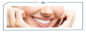 ابتسامة هوليود أنواعها وتكلفتها ومشاكلها