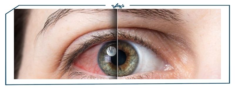 ما هي حساسية العين من الضوء ؟