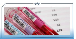 سرعة الترسيب