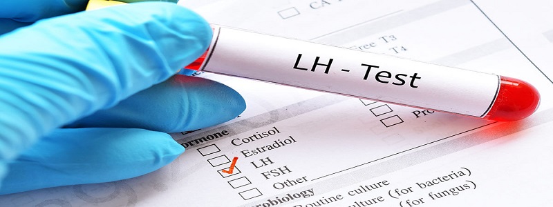 ما هو تحليل LH وماذا تعني نتائجه؟