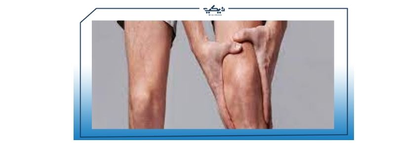 انتفاخ الركبة الأعراض وطرق العلاج