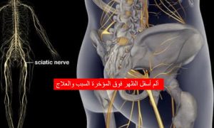 ألم أسفل الظهر فوق المؤخرة السبب والعلاج