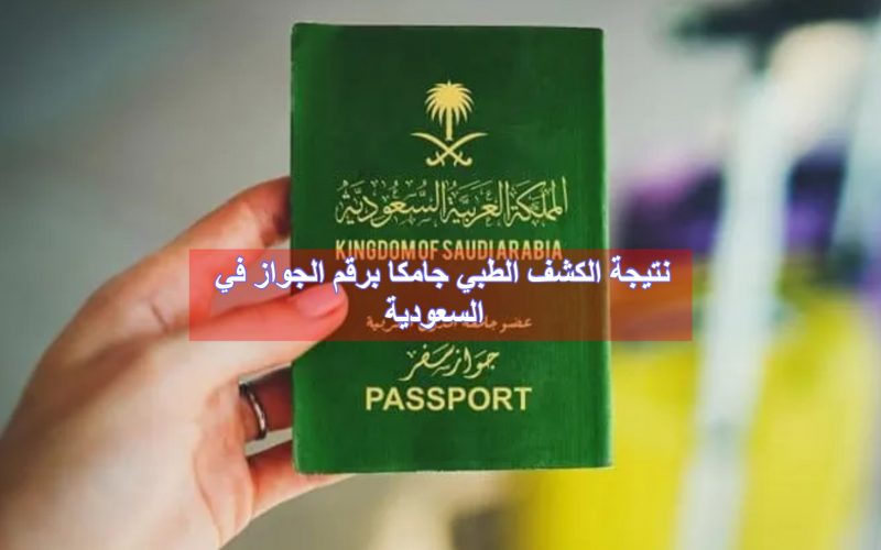 نتيجة الكشف الطبي جامكا برقم الجواز في السعودية