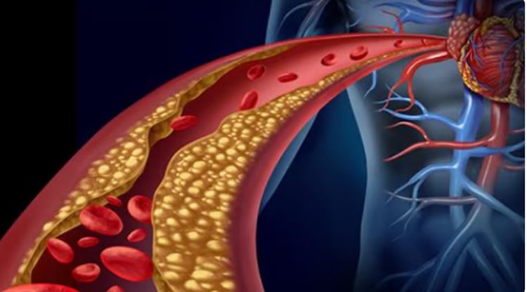 فهم مفهوم الكوليسترول: أسئلة وأجوبة