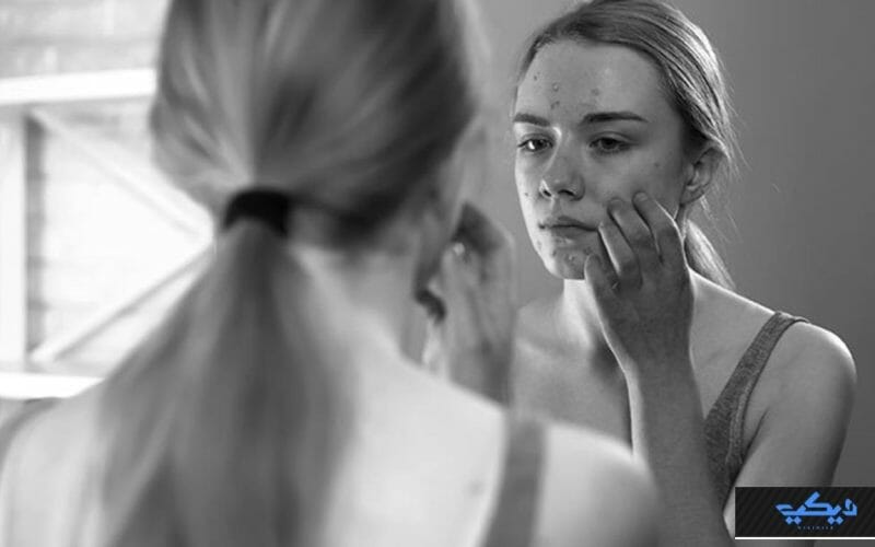 هل الإصابة بالاكتئاب تغير ملامح الوجه ؟