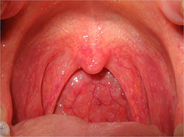 علاج فطريات الحلق