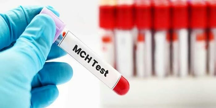 الفرق بين MCH و MCHC .. وماذا تكشف من أمراض