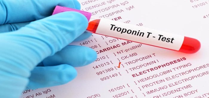 ما هو تحليل إنزيمات القلب Troponin – تروبونين