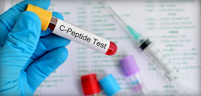 ماهو اختبار سي بيبتايد C – peptide