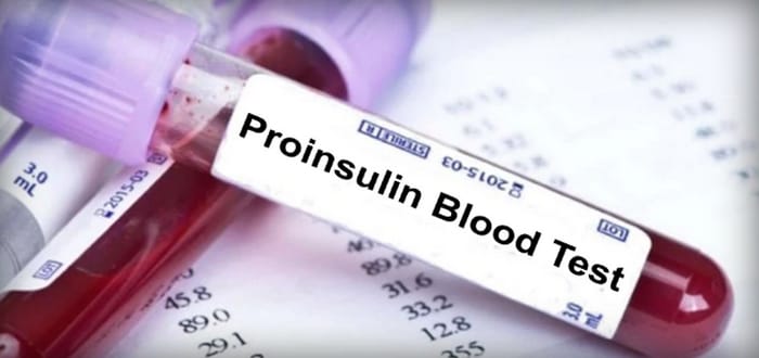 معلومات عن تحليل بروانسولين Proinsulin