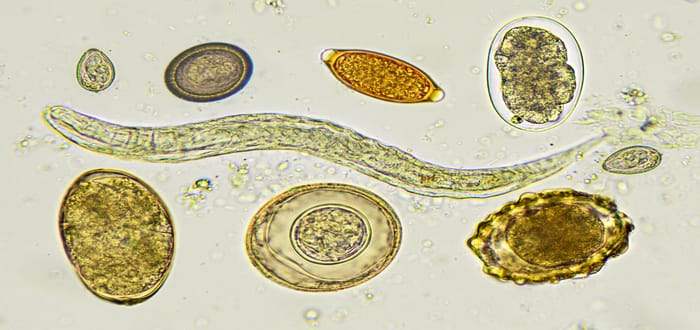 معنى Protozoa في تحليل البراز وتفسير النتائج