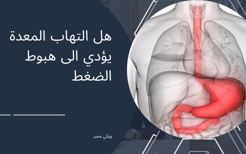 هل التهاب المعدة يؤدي الى هبوط الضغط