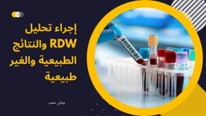 تحليل RDW