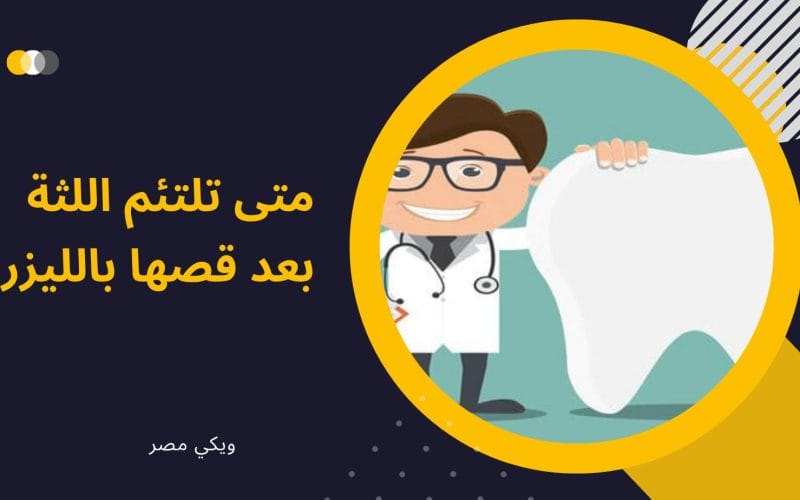 متى تلتئم اللثة بعد قصها بالليزر